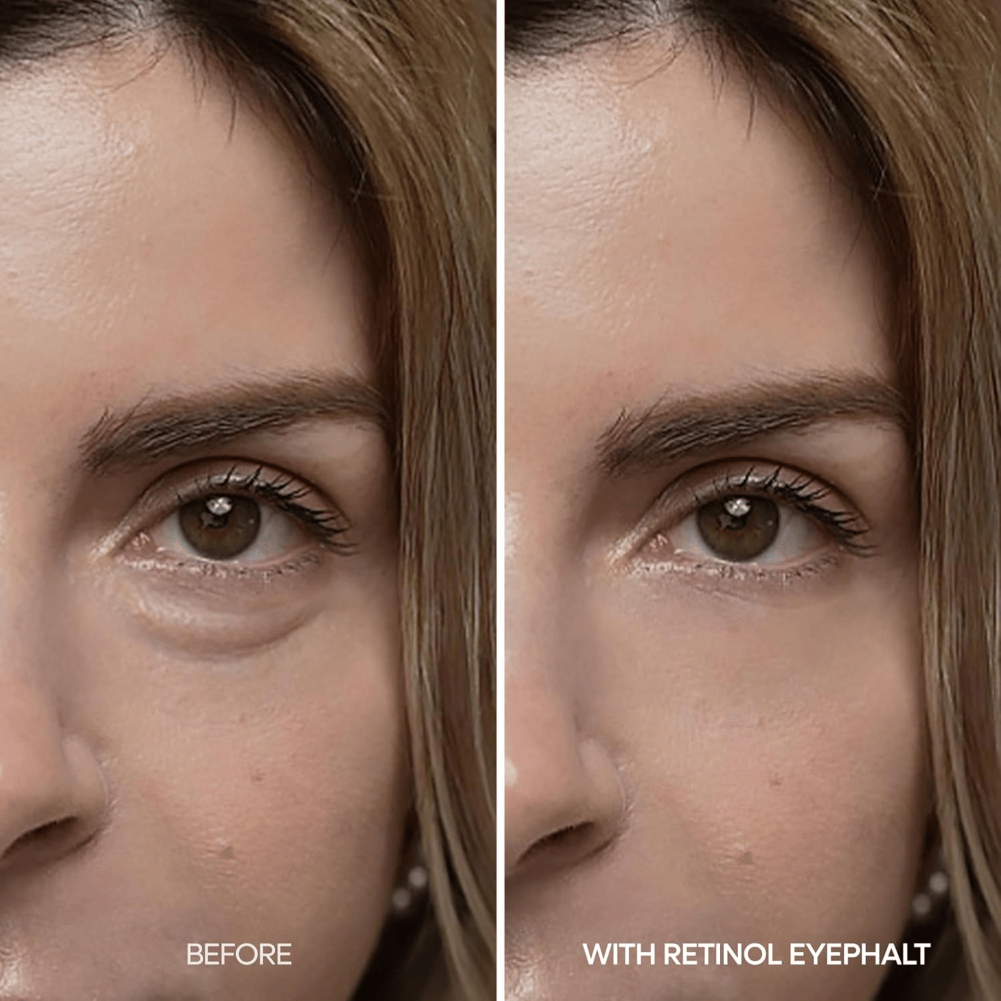 Dr.Melaxin Eyephalt Retinol Eyebag Cream - cosmadic