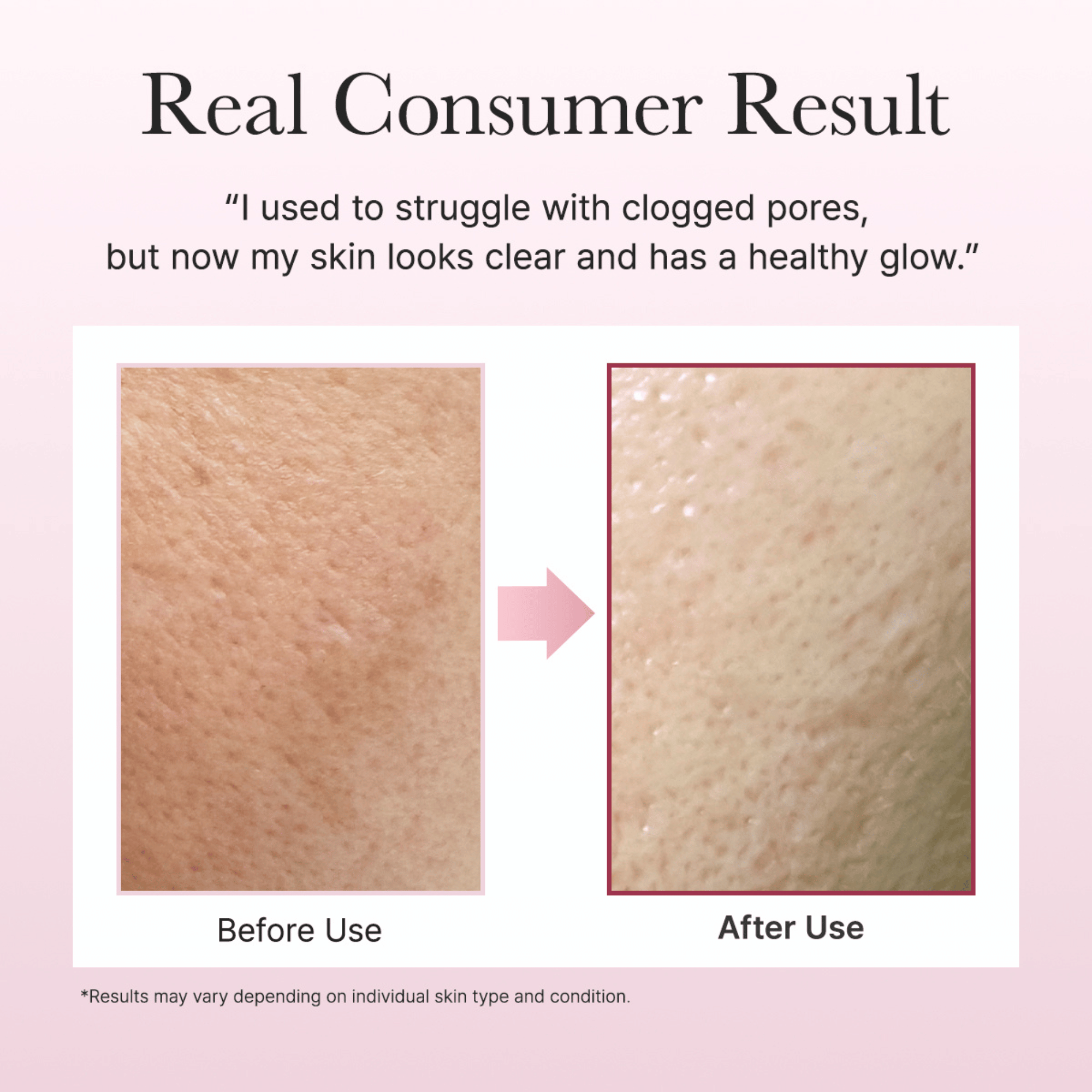 Arencia Fresh Rosehip Rice Mochi Cleanser 120g