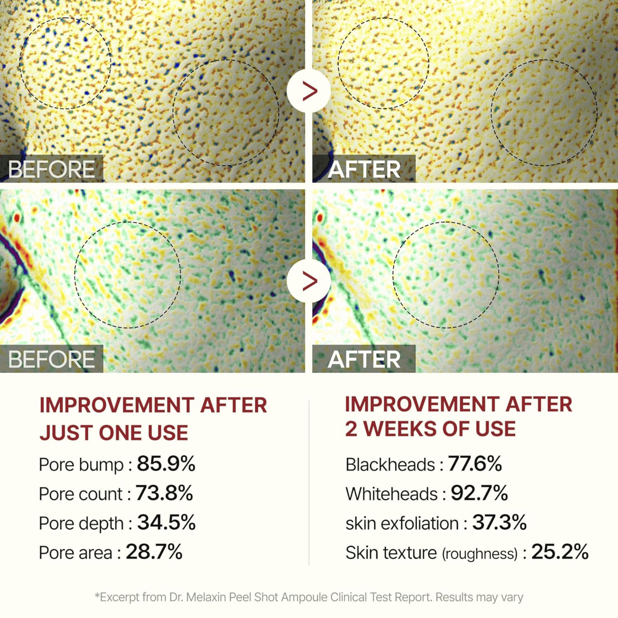 Dr.Melaxin Peel Shot Exfoliating White Rice Ampoule 80ml