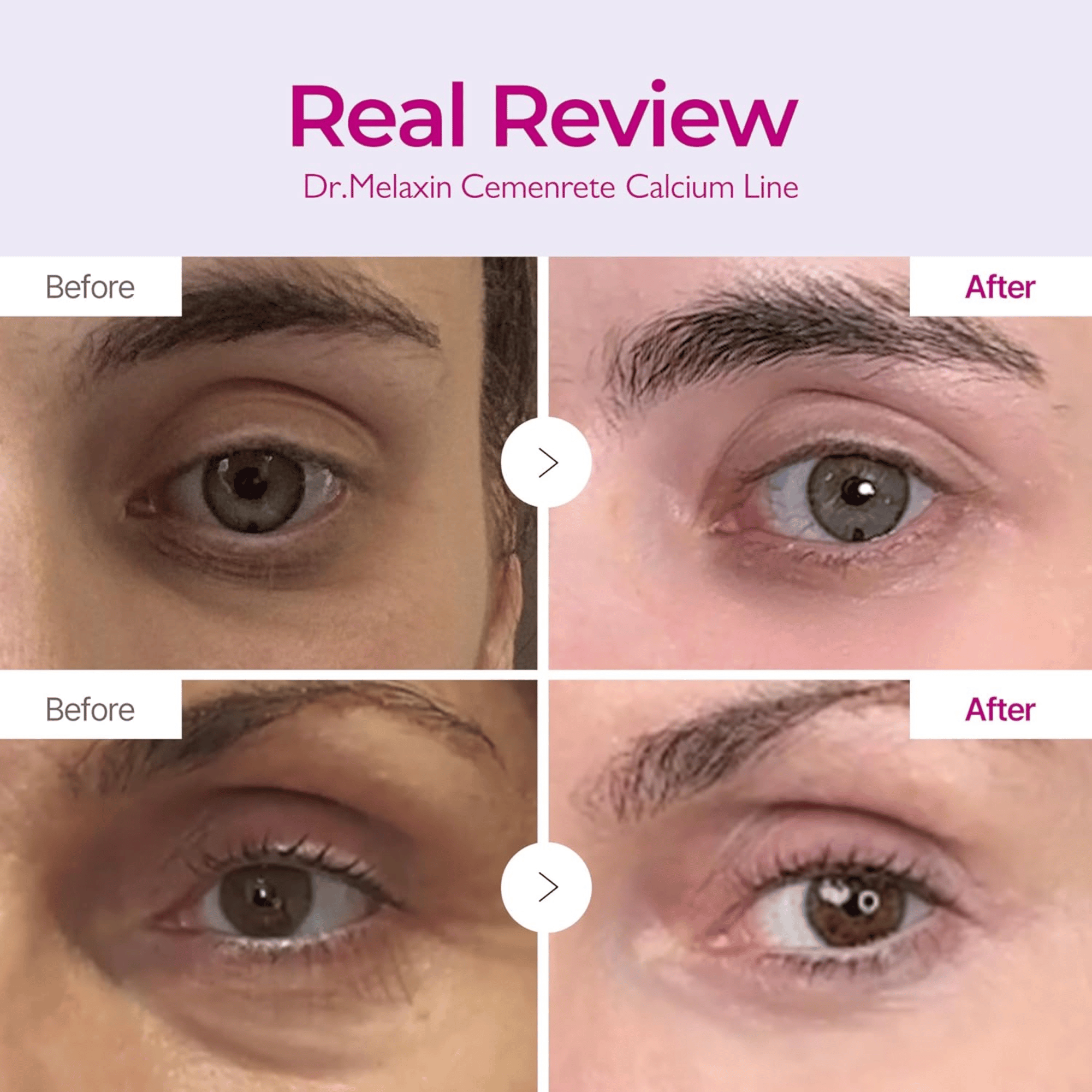 Dr.Melaxin Cemenrete Calcium Volume Cream 50g - cosmadic