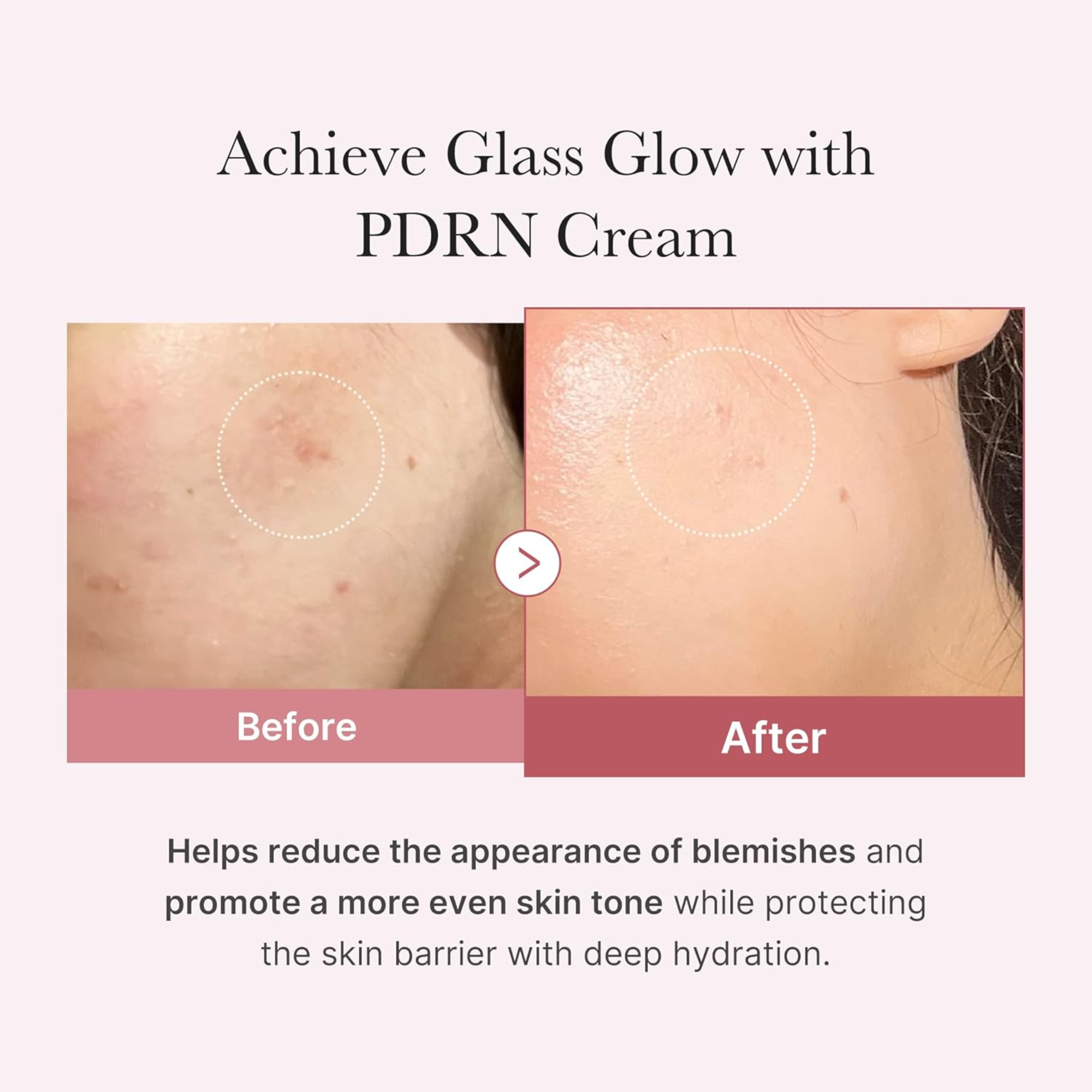 Medicube PDRN Pink Hyaluronic Moisturizing Cream 50ml - cosmadic