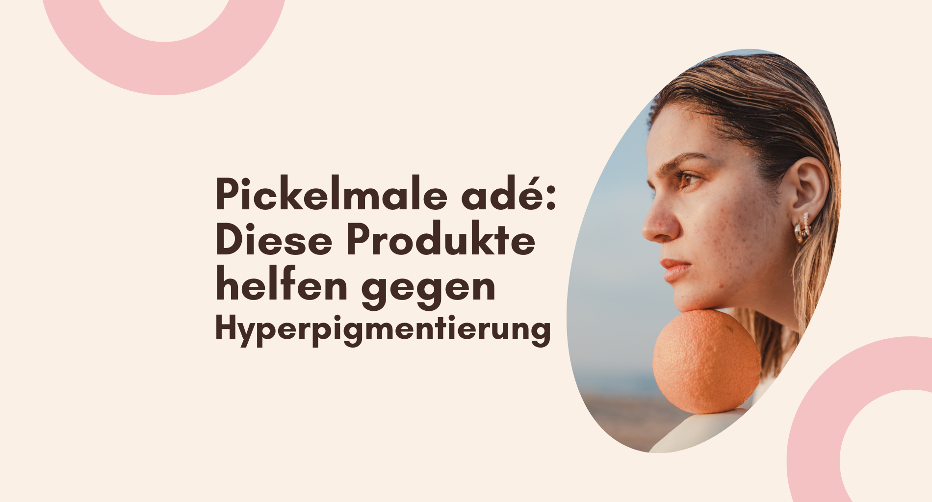 Pickelmale adé: Diese Produkte helfen gegen Hyperpigmentierung