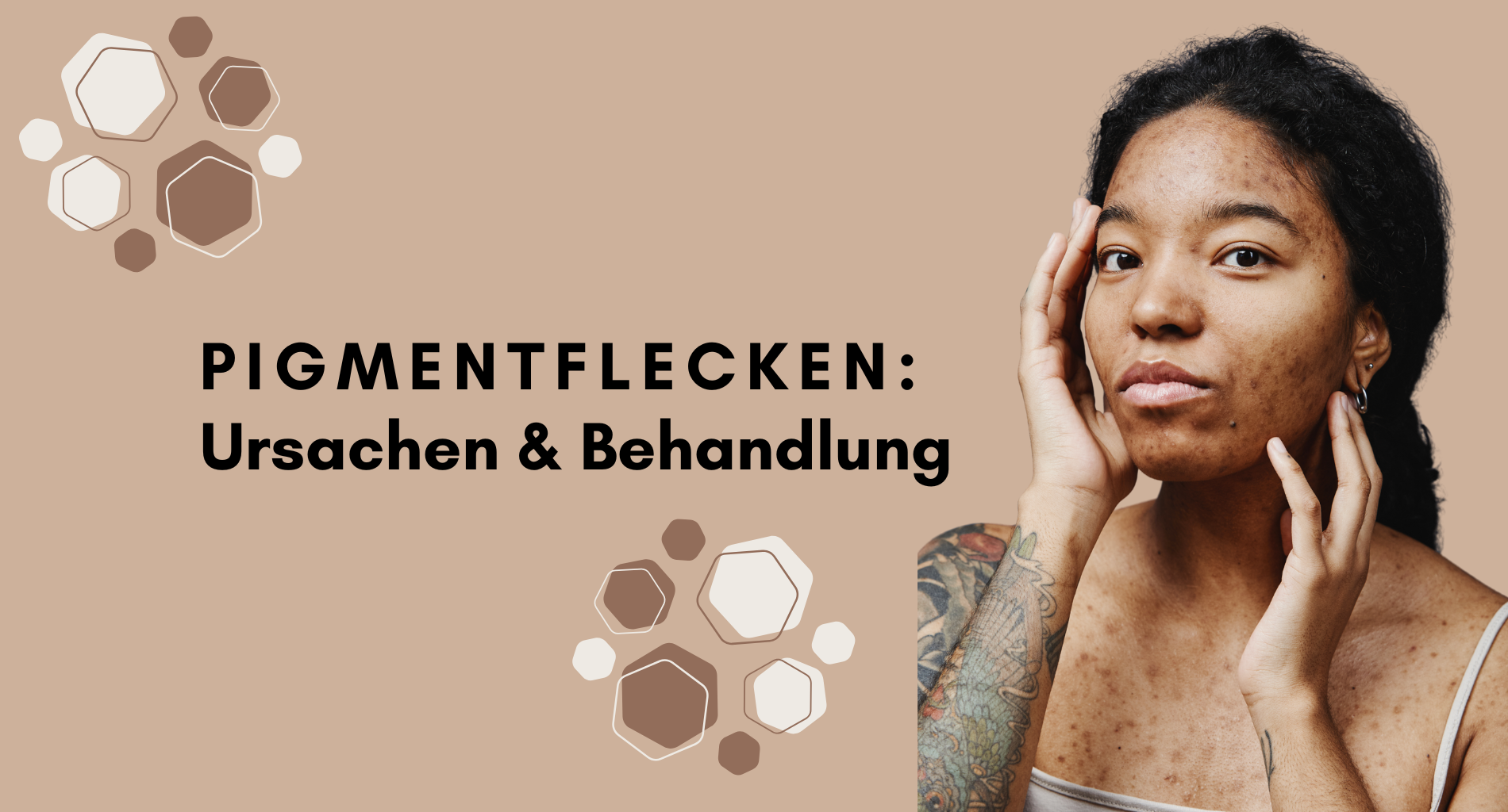 Pigmentflecken: Ursachen, Behandlung & die besten K-Beauty Wirkstoffe