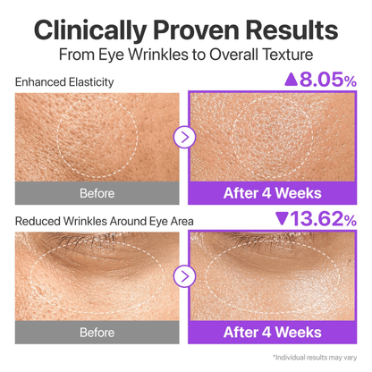 Numbuzin No. 9 NAD+ BIO Lifting-sil Essence 50ml - cosmadic