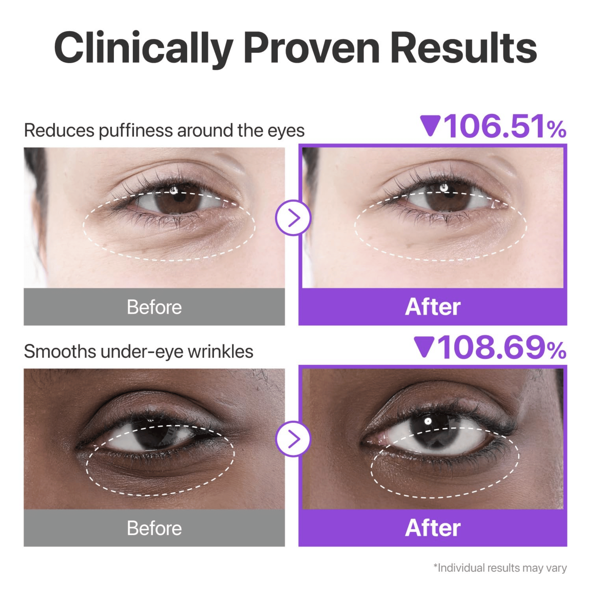 Numbuzin  No.9 NAD+ Collagen Under Eye Patches (5 Pairs)