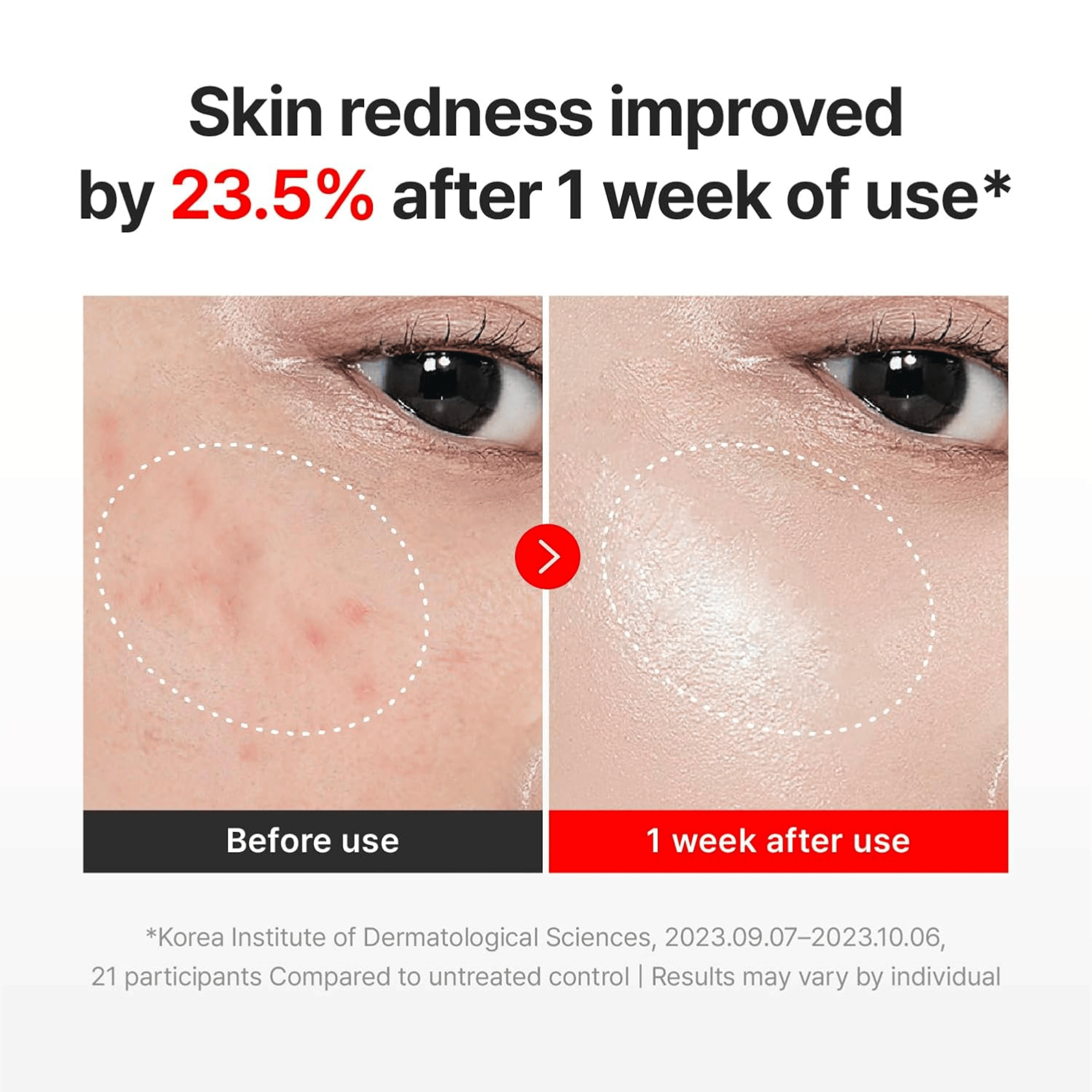 Centellian24 Madeca Cream Time Reverse 50ml - cosmadic