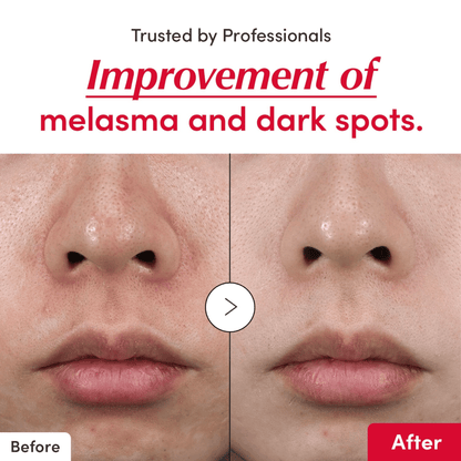 EQQUALBERRY Vitamin Illuminating Serum 30ml