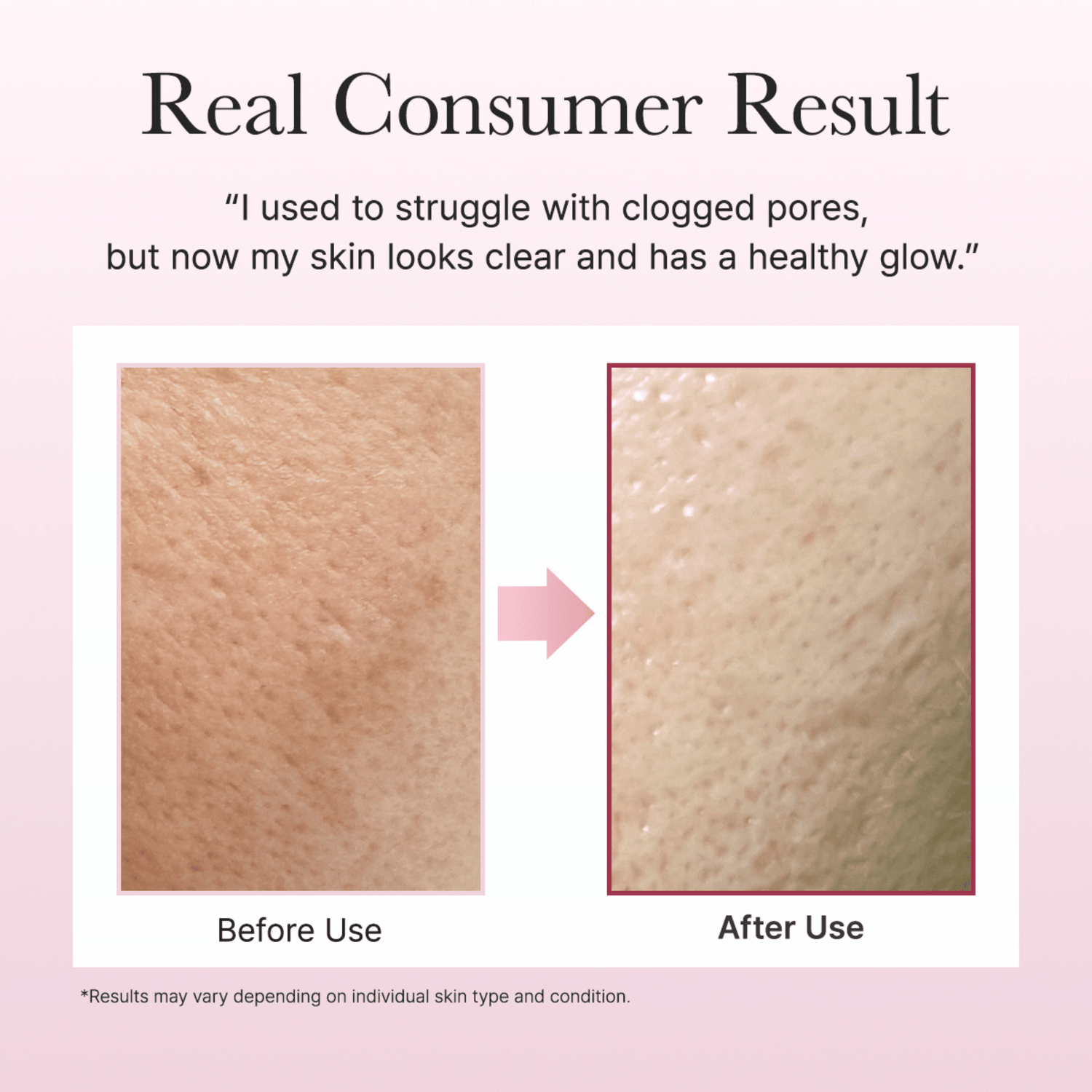 Arencia Fresh Rosehip Rice Mochi Cleanser 120g