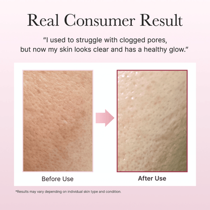 Arencia Fresh Rosehip Rice Mochi Cleanser 120g