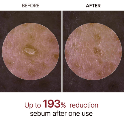 Dr.Melaxin Peel Shot Exfoliating White Rice Ampoule 80ml