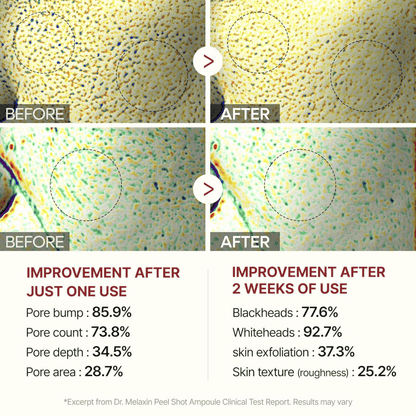 Dr.Melaxin Peel Shot Exfoliating Black Rice Ampoule 80ml