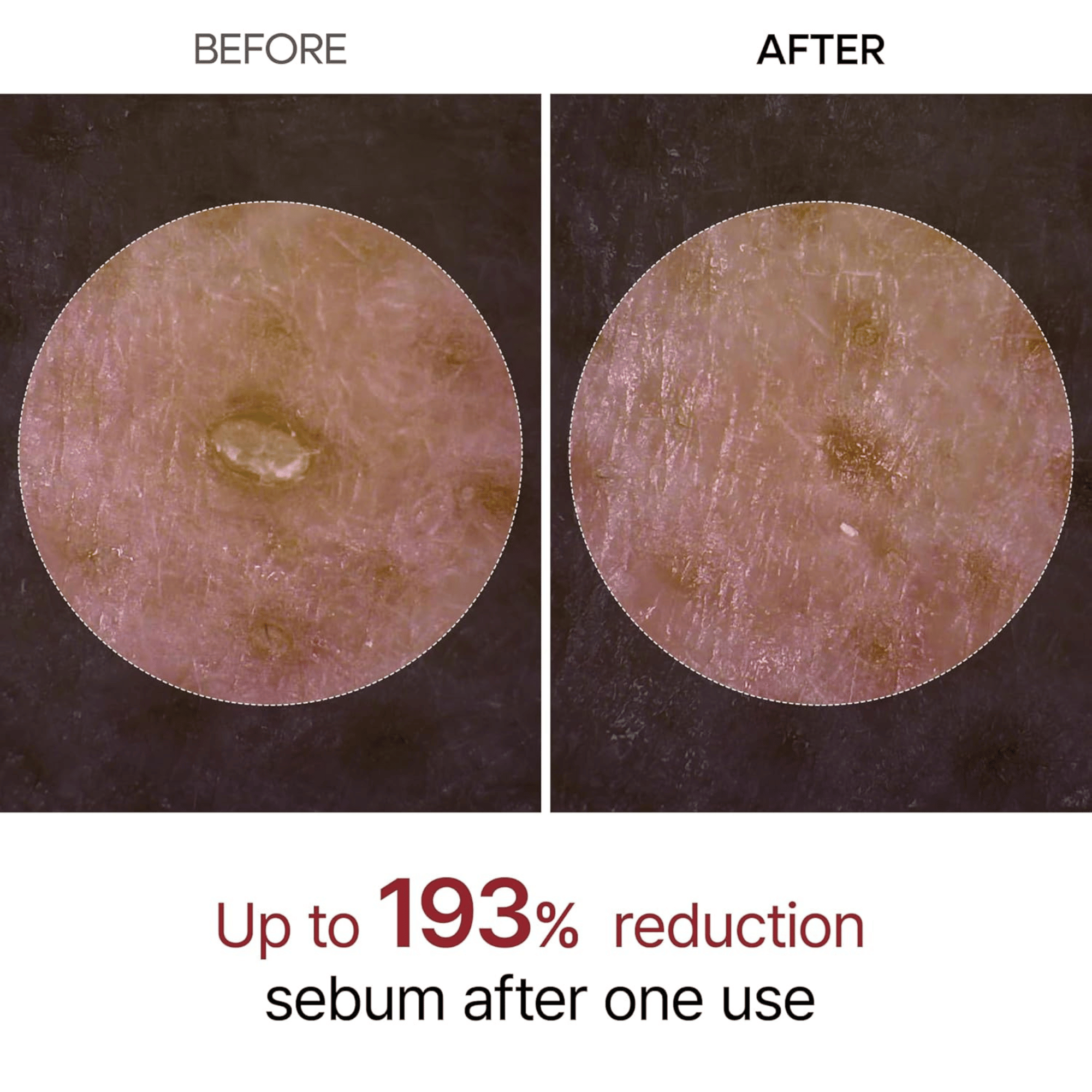 Dr.Melaxin Peel Shot Exfoliating Black Rice Ampoule 80ml