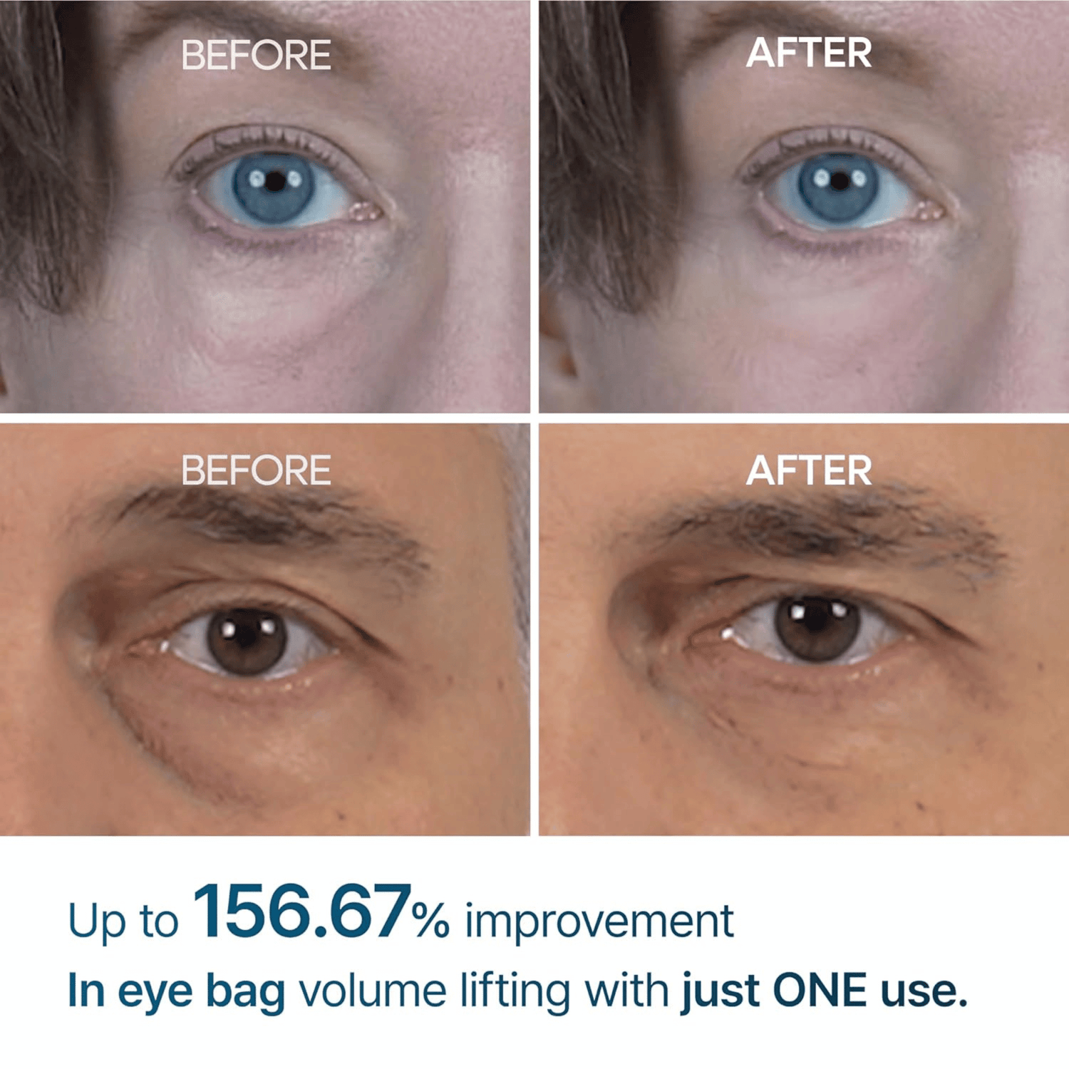 Dr.Melaxin Eyephalt Eyebag Cream 10ml