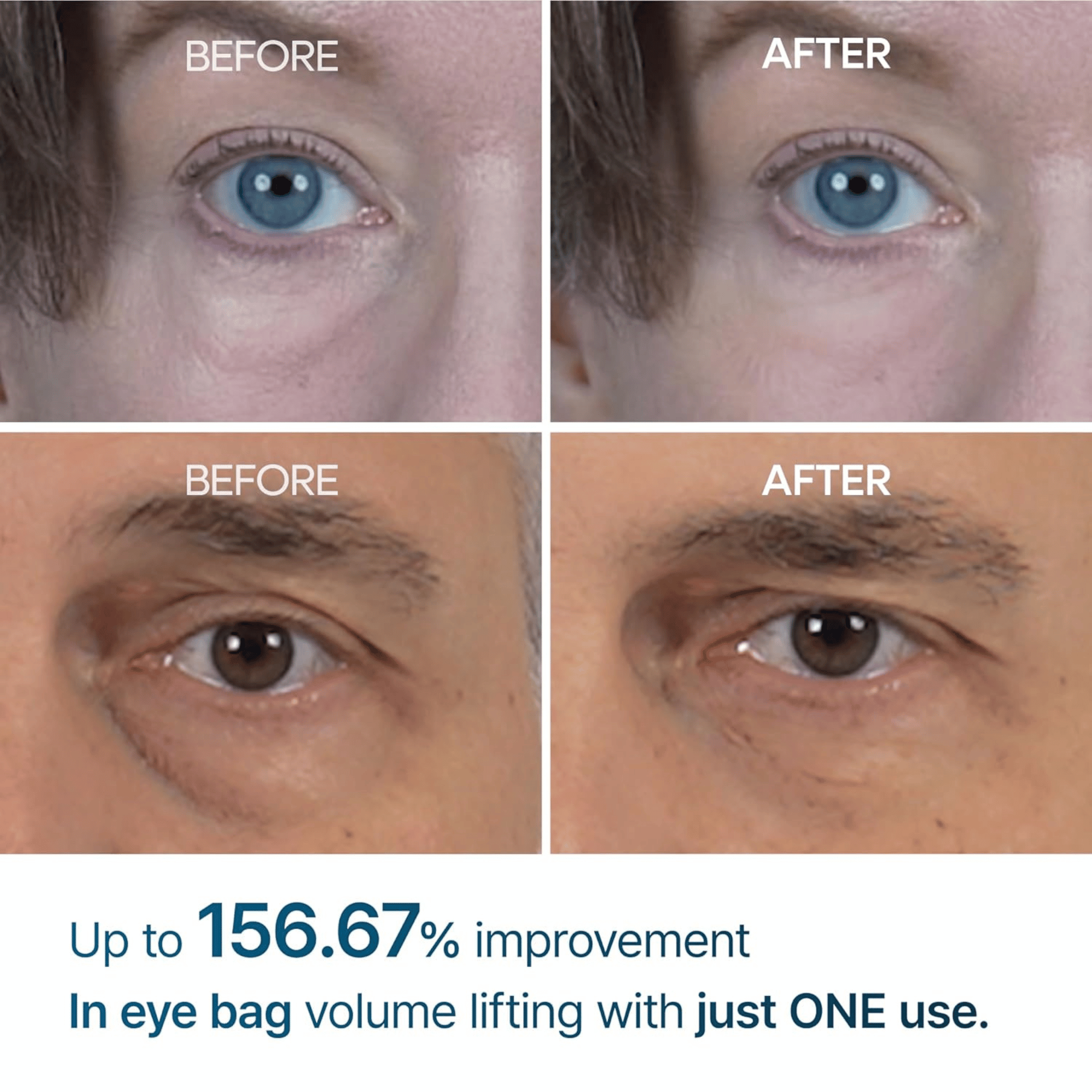 Dr.Melaxin Eyephalt Eyebag Cream 10ml