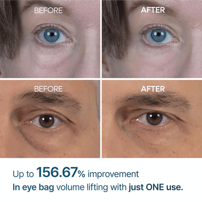 Dr.Melaxin Eyephalt Eyebag Cream 10ml