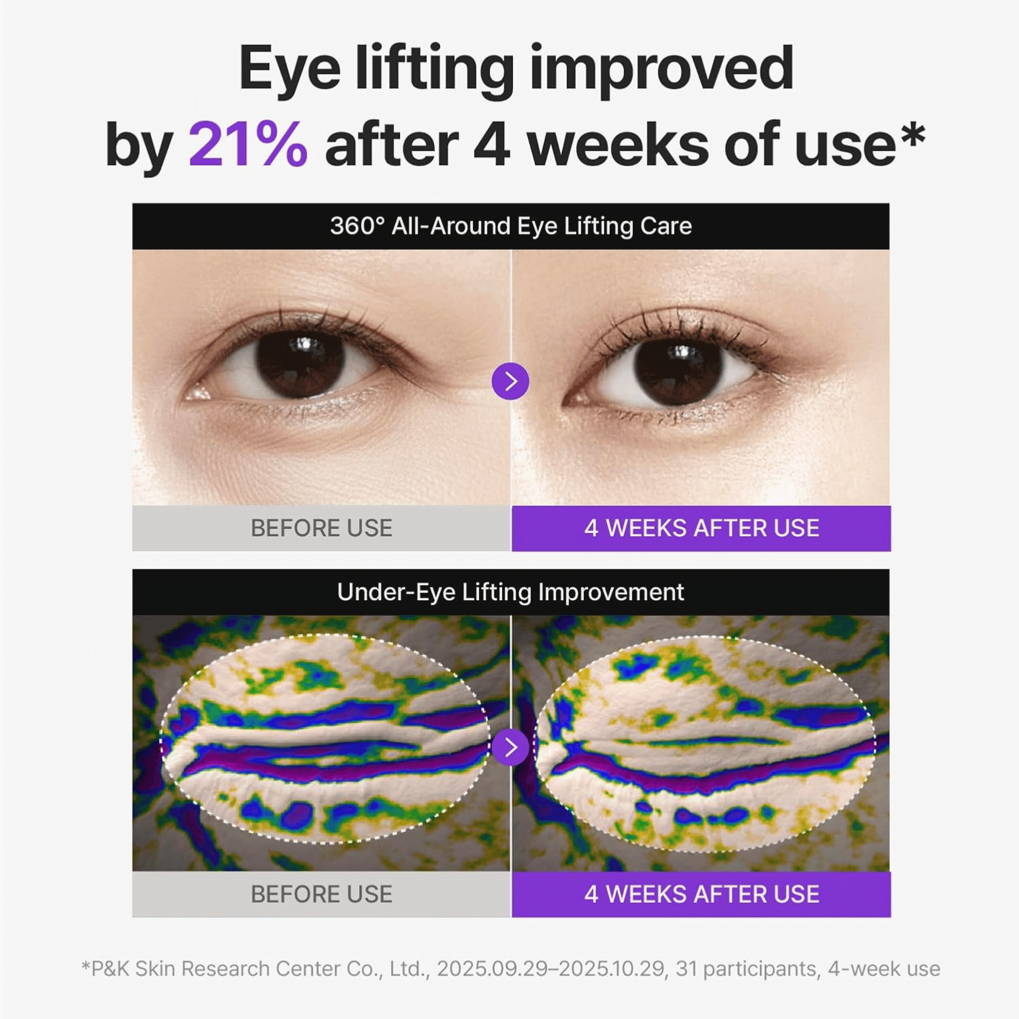 Centellian24 360 Shot PDRN Lifting Eye Cream 30ml - cosmadic