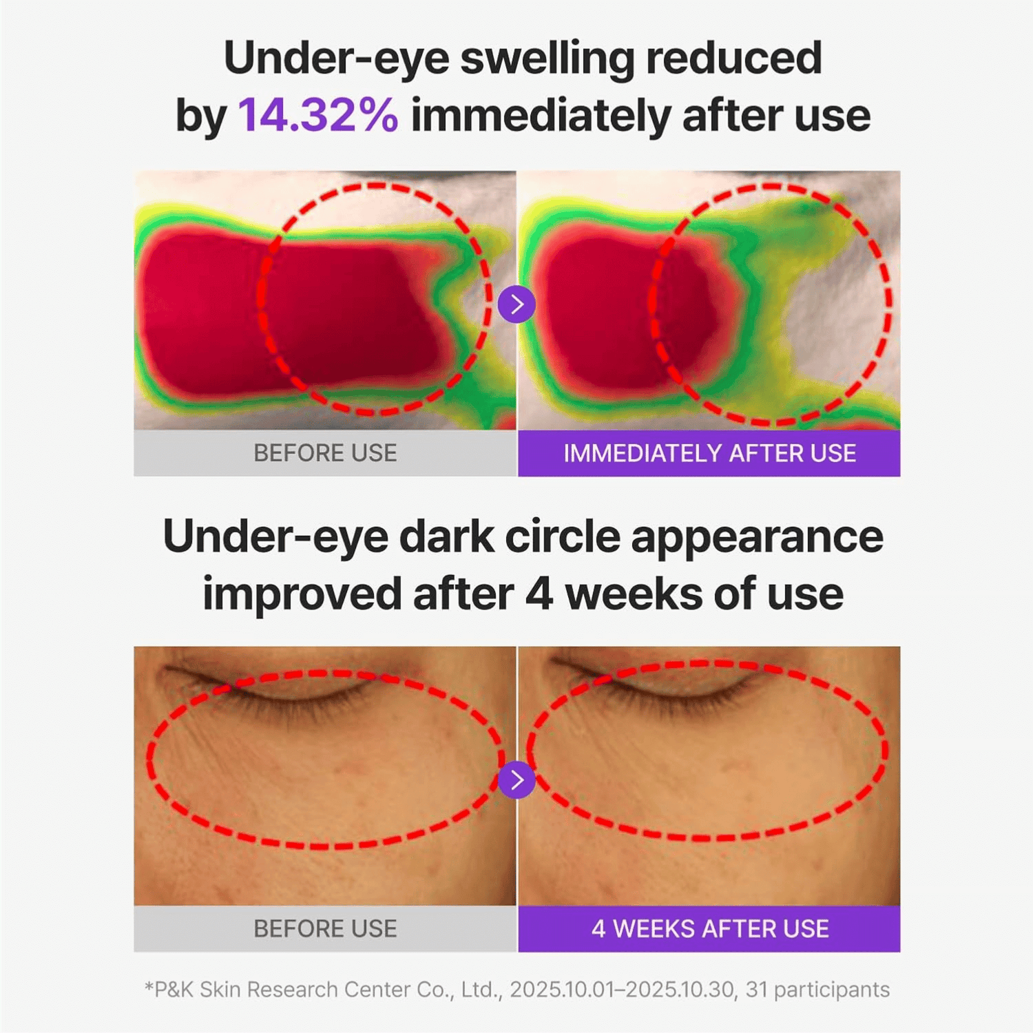 Centellian24 360 Shot PDRN Glowing Eye Patch - cosmadic