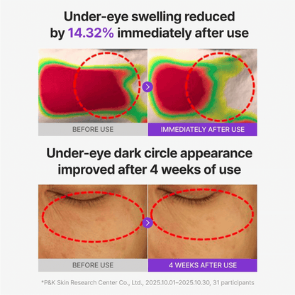 Centellian24 360 Shot PDRN Glowing Eye Patch - cosmadic