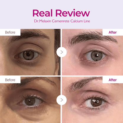 Dr.Melaxin Cemenrete Calcium Volume Cream 50g - cosmadic