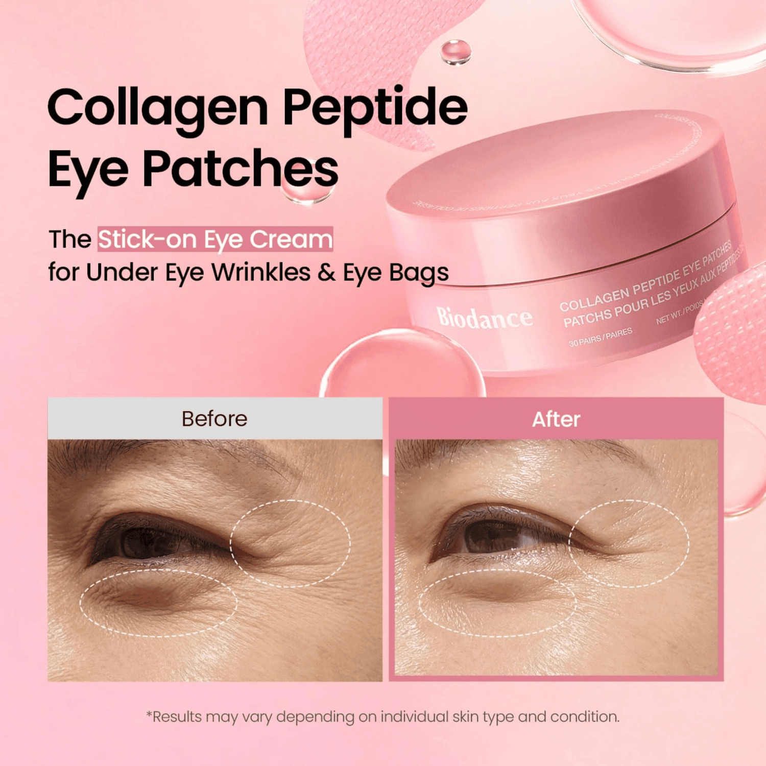 Biodance Collagen Peptide Eye Patches 30 Stk - cosmadic