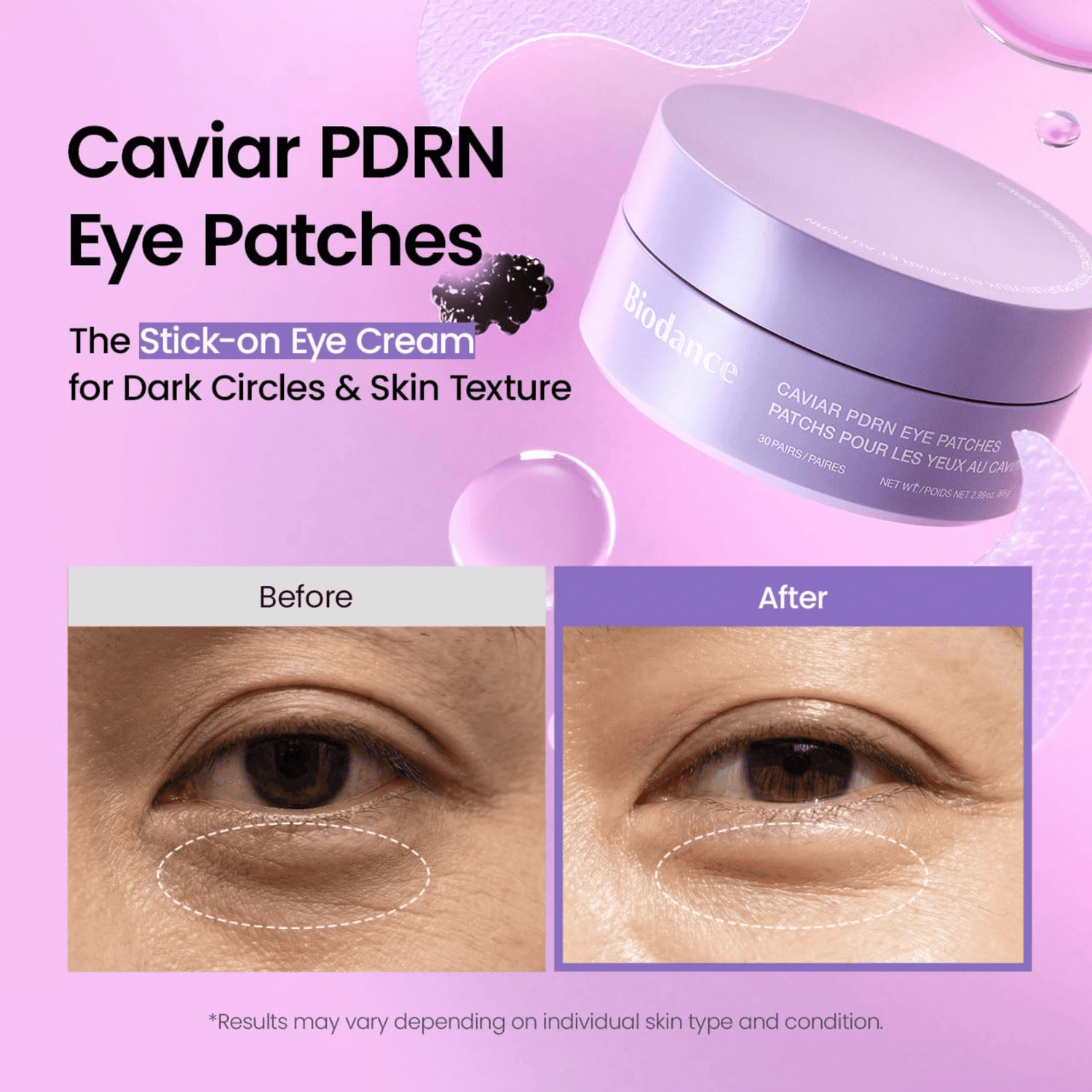 Biodance Caviar PDRN Eye Patches 30 Stk - cosmadic