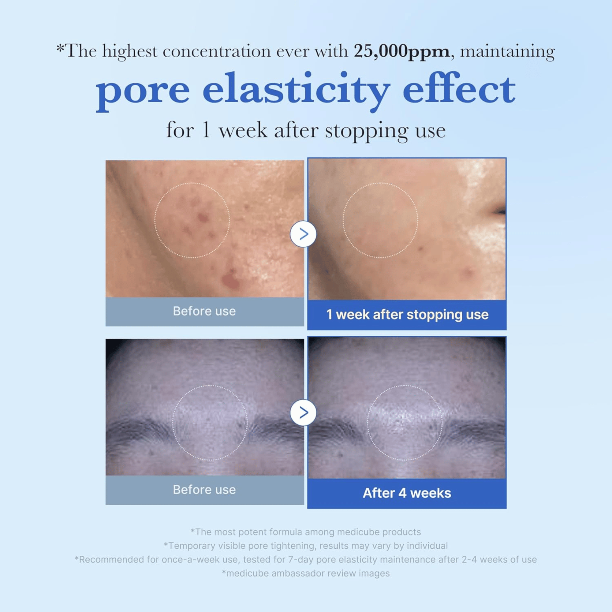 Medicube One Day Exosome Shot Pore Serum 25000 - cosmadic