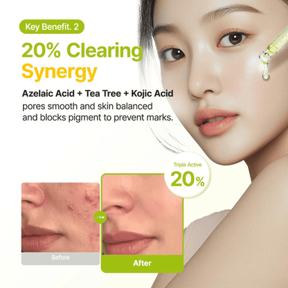 Purito Seoul Azelaic Acid 10 Kojic Tea Tree Serum 30ml - cosmadic