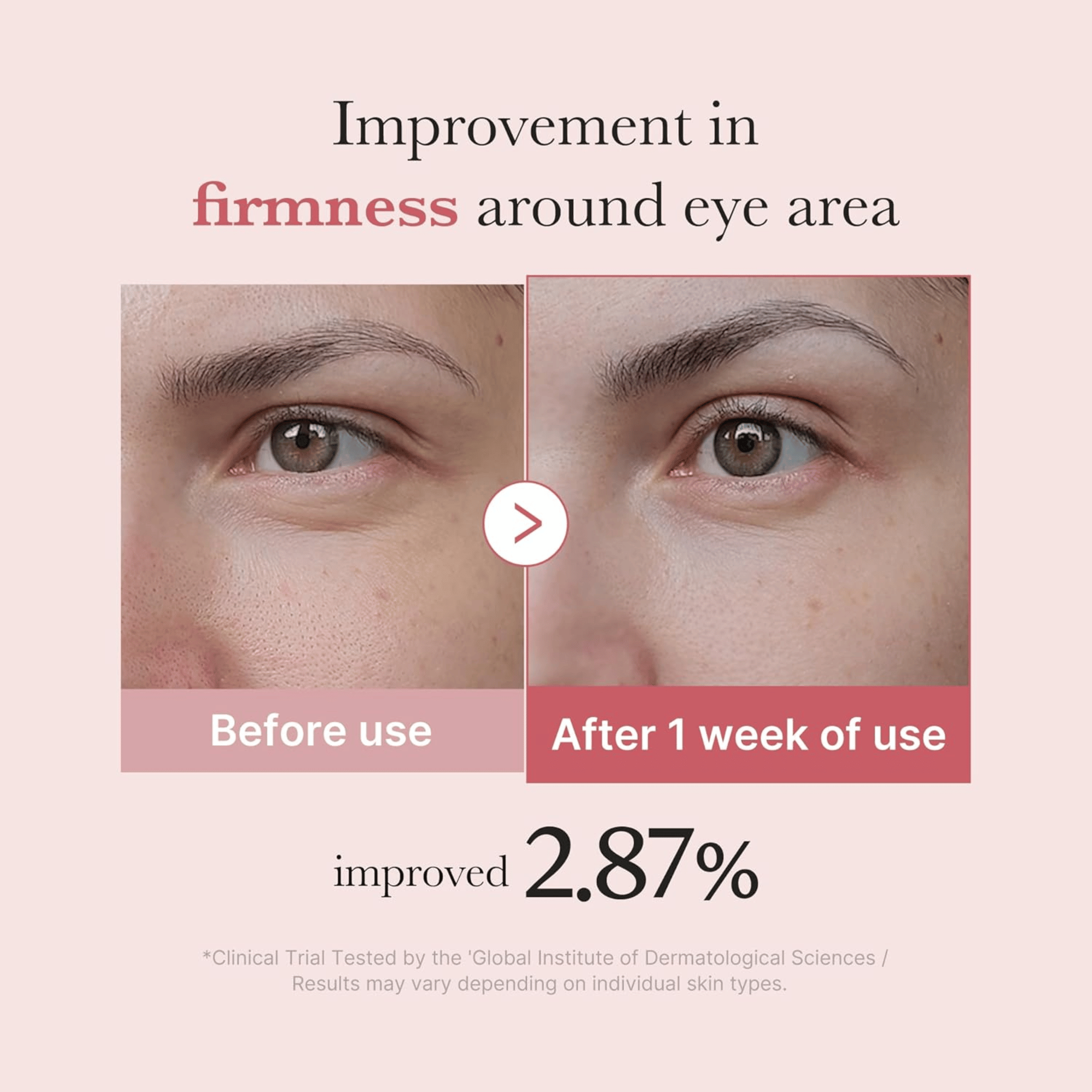 Medicube PDRN Pink Peptide Eye Cream 30ml - cosmadic