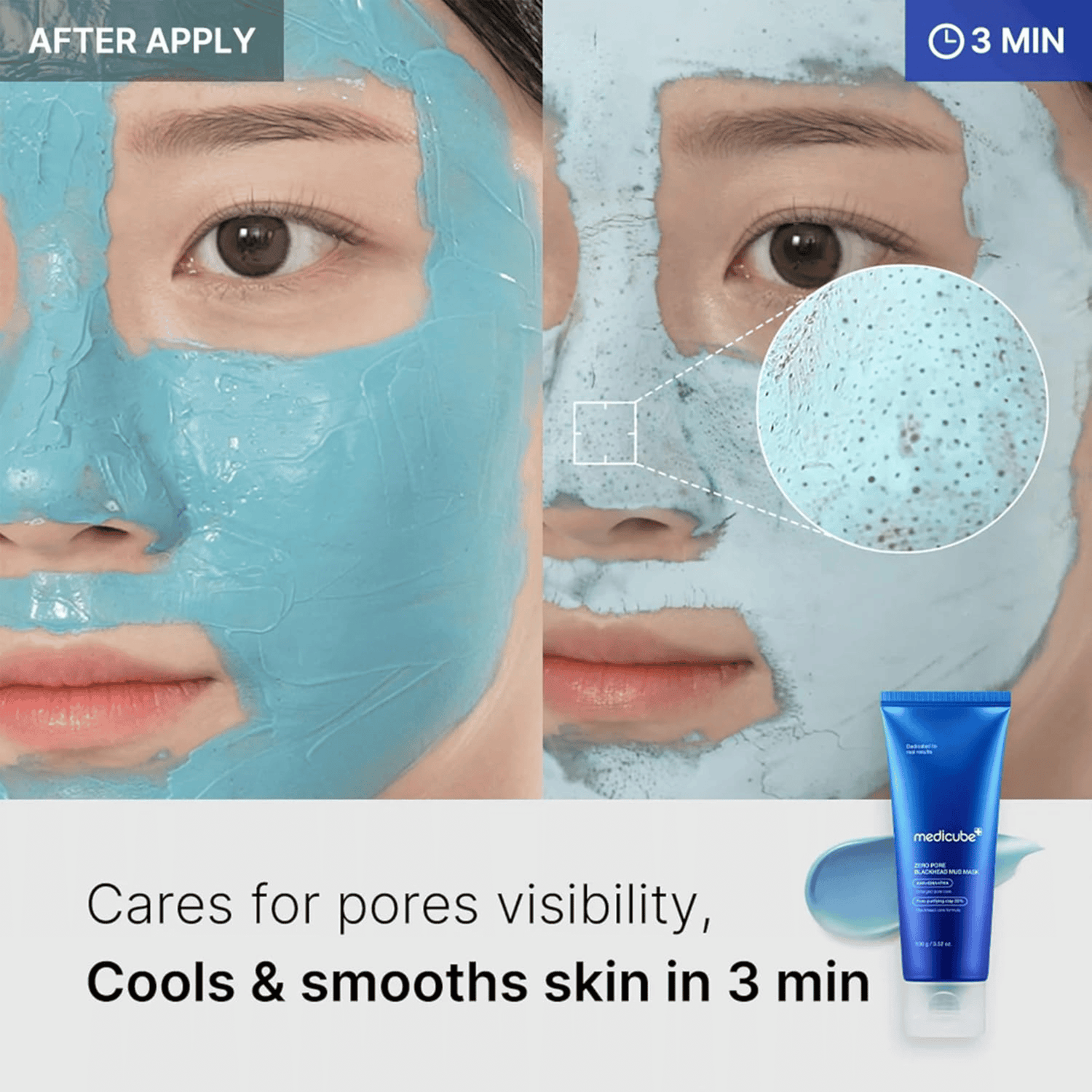 Medicube Zero Pore Blackhead Mud Mask 100g - cosmadic