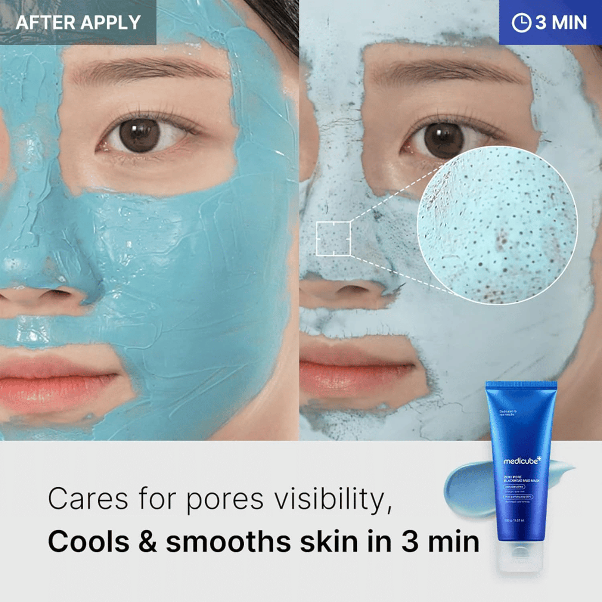 Medicube Zero Pore Blackhead Mud Mask 100g - cosmadic
