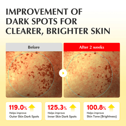 EQQUALBERRY EQQUALBERRY Vitamin Illuminating Toner 150ml - cosmadic