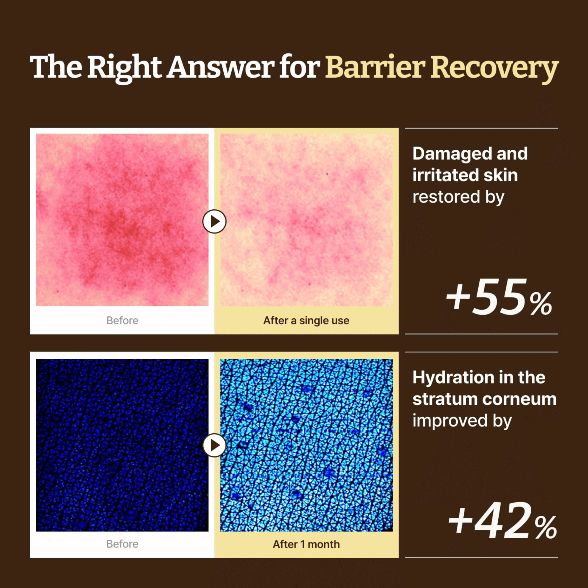 Dr. Reju-All Advanced LC-Ceramide Barrier Cream 50ml - cosmadic